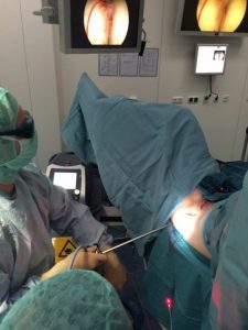 Θεραπεία Αιμορροΐδων με Laser