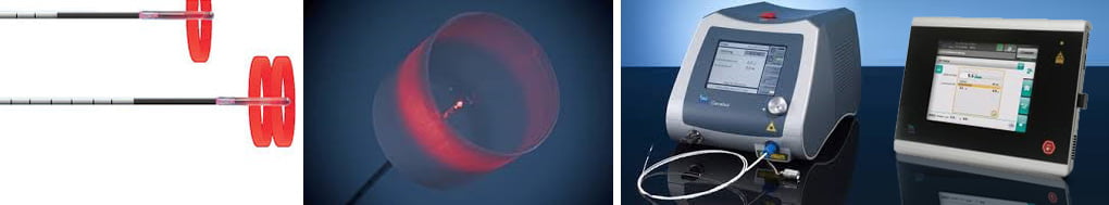 Θεραπεία Αιμορροΐδων με Laser