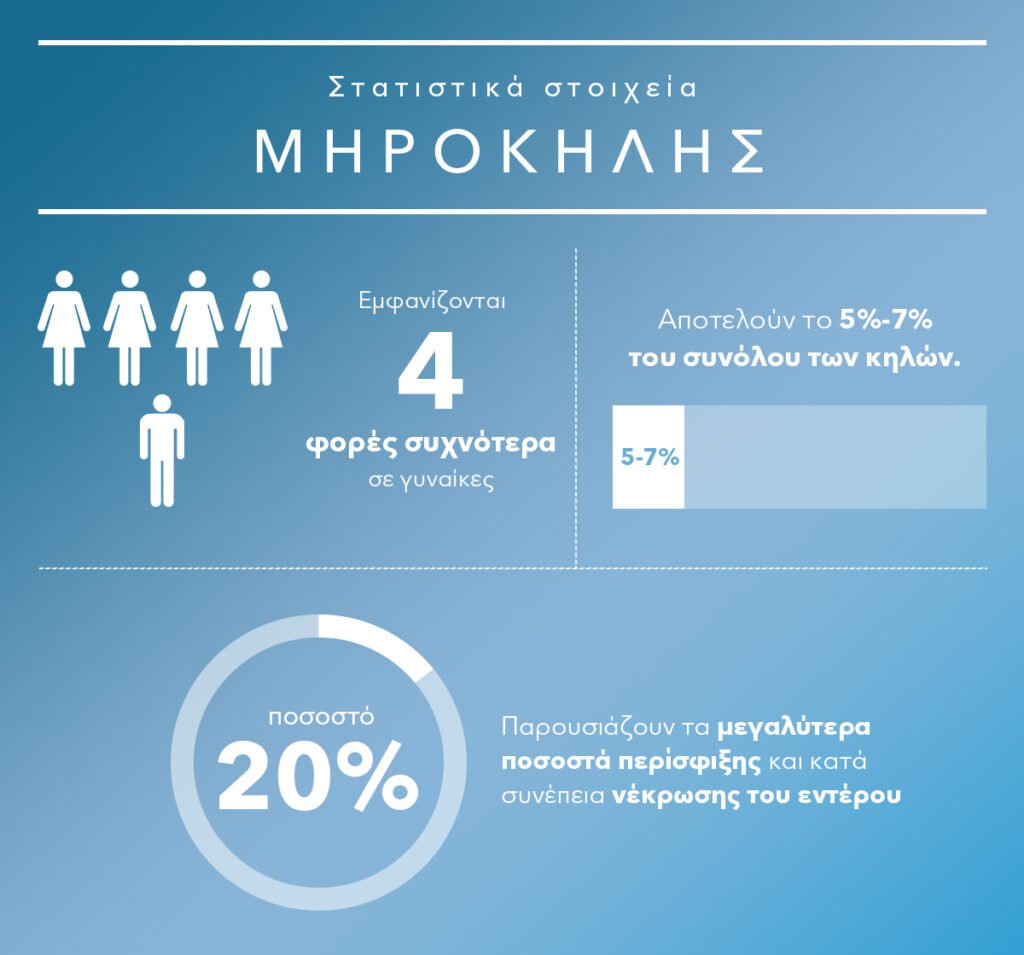 Μηροκήλη