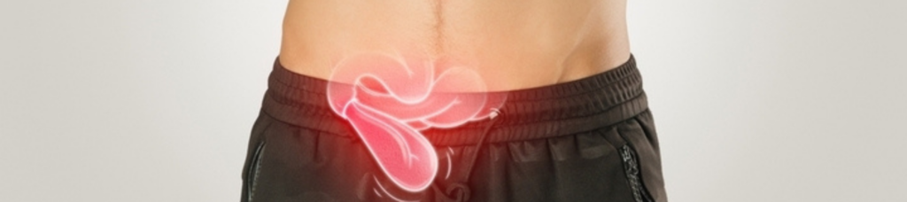 Βουβωνοκήλη